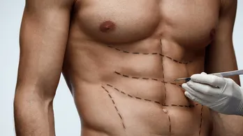 'Six-pack surgery' gaining popularity among men, say plastic surgeons