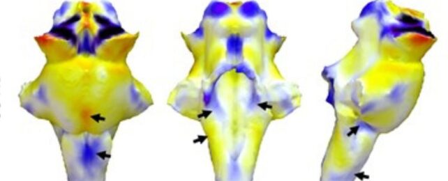 We Just Got More Evidence That Long COVID Is a Brain Injury